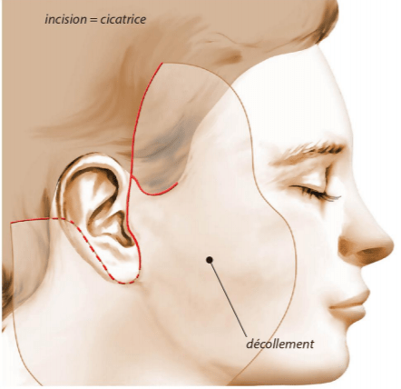 Intervention cervico-facial