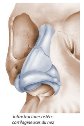 Intervention rhinoplastie
