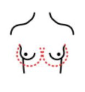 Chirurgie mammaire